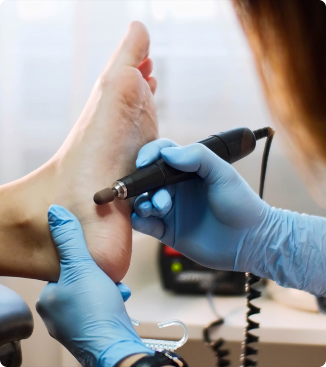 Clinician performing a routine nail and callus procedure in a podiatry clinic
